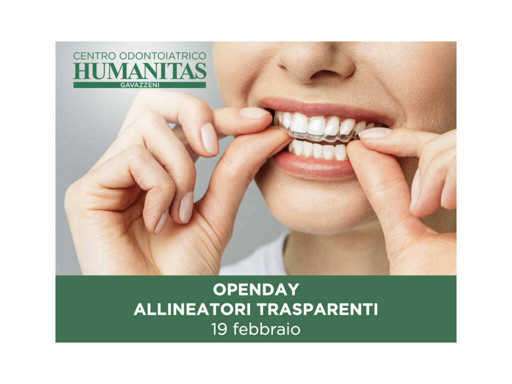Scopri la soluzione trasparente per i denti disallineati - BergamoNews